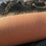 Skąd bierze się gęsia skórka i po co nam ta reakcja